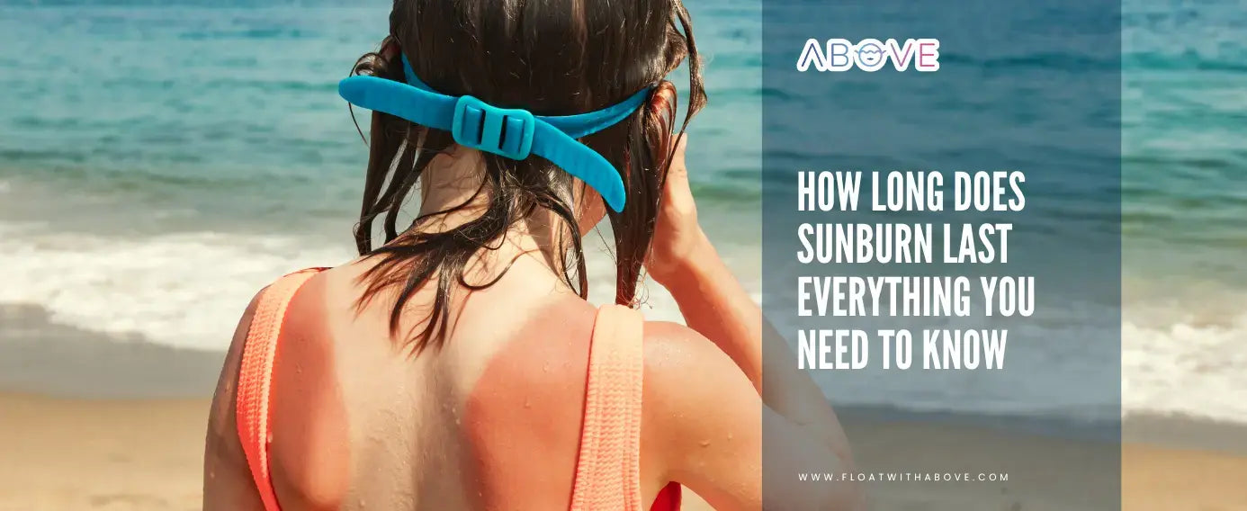 How Long Does Sunburn Last Float With Above Above