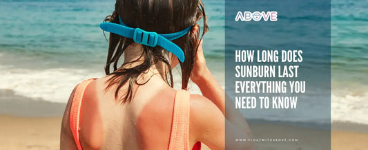 How-Long-Does-Sunburn-Last-Everything-You-Need-To-Know